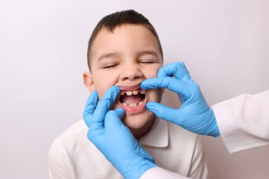 Bebek dişleri eksik bir çocuğun ağız boşluğunu inceliyorlar. Diş sağlığı ve diş bakımı.