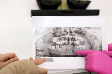 Diş hekimi hastaya dişlerin röntgenini gösterir, tedavi yöntemini belirler. Diş hekimliği kavramı.