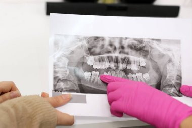 Diş hekimliği. Diş hekimi hastaya diş röntgenlerini tavsiye eder ve tedavi yöntemini belirler..
