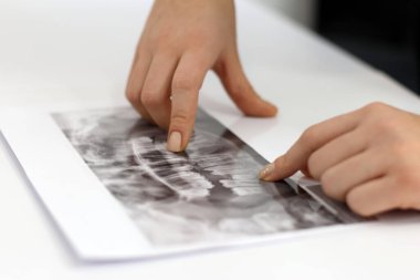 Diş hekimi dişlerin panoramik röntgenini inceler ve tedavi yöntemini belirler. Diş hekimliği kavramı.