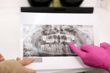 Diş hekimliği. Diş hekimi hastaya diş röntgenlerini tavsiye eder ve tedavi yöntemini belirler..