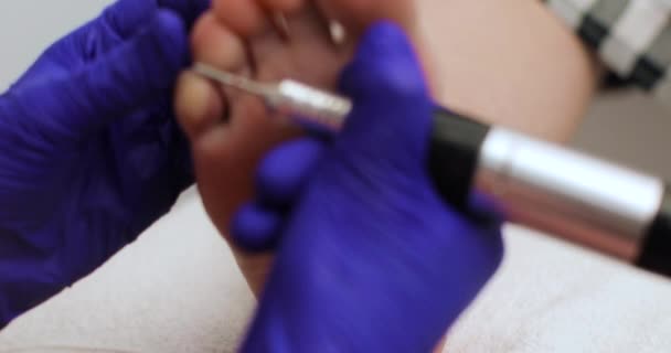 在美容院里 有一位美容师用电子脚档将病人的足部皮肤归档 这对美容师的手进行了近距离检查 — 图库视频影像