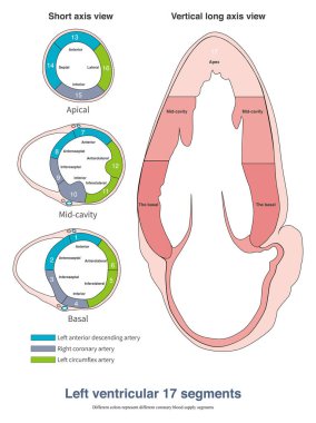 Sol ventrikül 17 segmente bölünür ve farklı koroner arterler farklı segmentler için kan sağlar..
