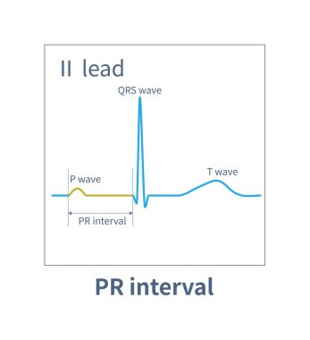 ECG 'nin halkla ilişkiler aralığı P dalgasının başlangıç noktasından QRS dalgasının başlangıç noktasına kadar olan zamanı ifade eder, ki bu da iletim sisteminde elektriksel uyarıların iletildiği zamandır..
