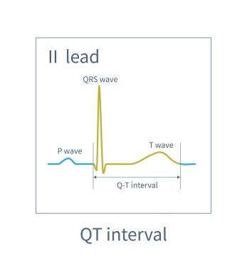 The QT interval of ECG is from the beginning of QRS wave to the end of T wave, representing the total time of ventricular depolarization and repolarization.
