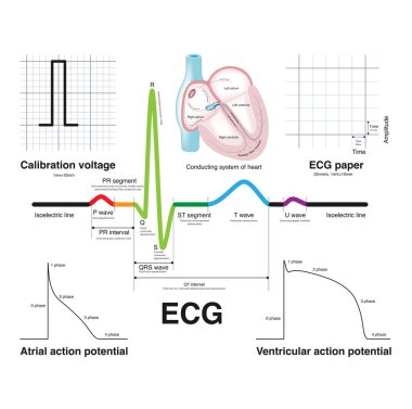 Atrial depolarizasyon P dalgası oluşturur, ventriküler depolarizasyon QRS dalgası oluşturur ve ventriküler repolarizasyon T dalgası oluşturur, bu da elektrokardiyogramın yaygın bir dalga biçimini oluşturur..