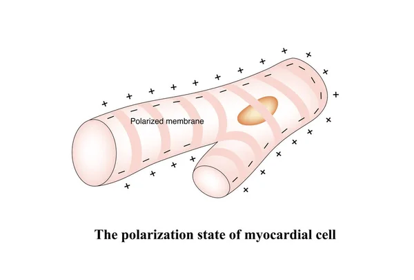 When myocardial cells are not stimulated, they carry positive charges outside the cell membrane and negative charges inside the cell membrane, which is called a polarized state.