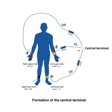 Sol üst uzvun, sağ üst uzvun ve sol alt uzvun kabloları birbirine bağlanarak negatif elektrot olarak kullanılabilecek merkezi bir terminal oluştururlar..