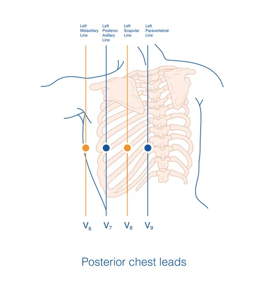 Coloque el electrodo de exploración del electrocardiograma de