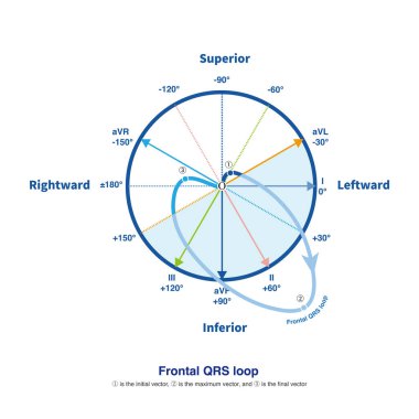 Ventriküler depolarizasyon sırasında, bir uzaysal QRS döngüsü oluşturulur, ön kurşun sistemi üzerine yansıtılır, ön QRS döngüsünü oluşturur, bu da elektrokardiyogramı oluşturur..