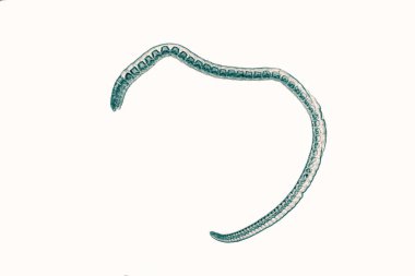 Schistosoma japonicum is a parasite that causes human schistosomiasis, and is mainly prevalent in Asia, causing damage to the human liver and portal vein system. clipart