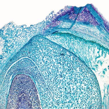 Bu, Çin gülü kekemeliğinin büyütülmüş bir fotoğrafı..