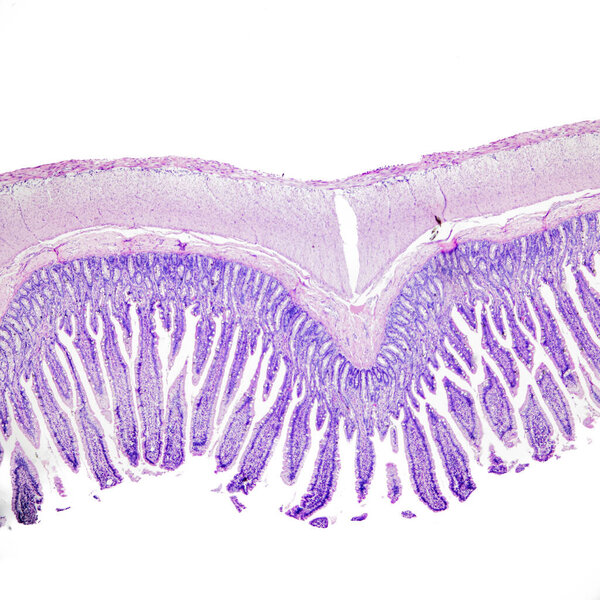 This is a histological photograph of the human small intestine. Magnify 40x.