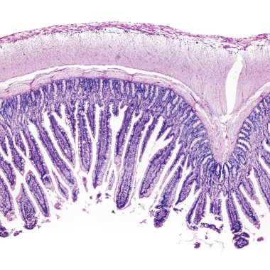 This is a histological photograph of the human small intestine. Magnification 40x clipart
