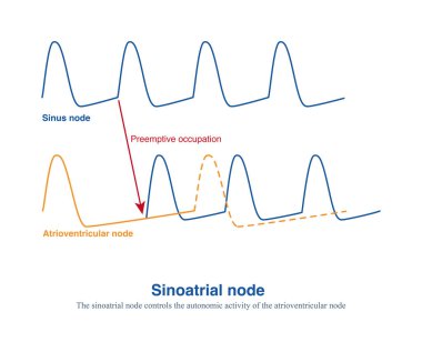 The autonomic  frequency of the sinoatrial node is the fastest, and other secondary pacemakers are controlled through mechanisms of preemptive occupation and overspeed suppression. clipart