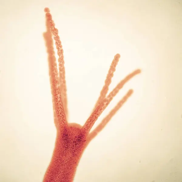 stock image Hydra is a small genus of freshwater hydroids of the phylum Cnidarians, which are native to temperate and tropical regions and have the ability to regenerate and do not age. Magnify 100x