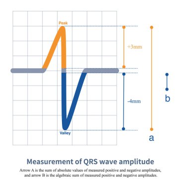 Farklı ölçüm amaçlarına göre, QRS dalgasının genliği pozitif ve negatif dalga biçimlerinin mutlak değerlerinin toplamını ve cebirsel değerlerin toplamını içerir..