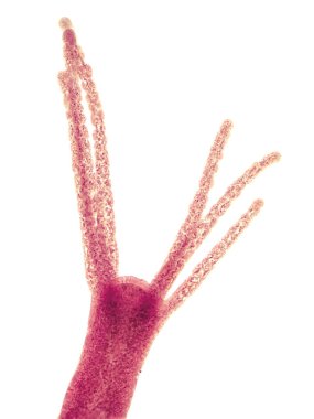 Hydra is a small genus of freshwater hydroids of the phylum Cnidarians, which are native to temperate and tropical regions and have the ability to regenerate and do not age. Magnify 100x clipart