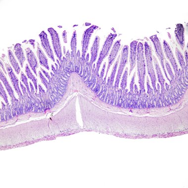 Bu insan ince bağırsağının histolojik bir fotoğrafı. Büyütme 40x