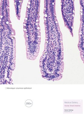 Bu insan ince bağırsağının histolojik bir fotoğrafı. Büyütme 200x