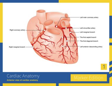 Koroner arterler sol koroner arter ve sağ koroner arter sistemine bölünmüş..