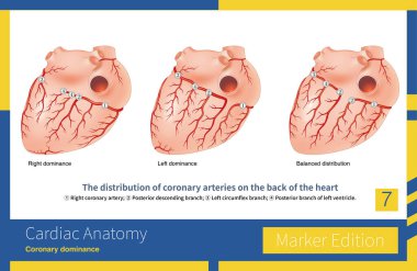 Genel nüfusun çoğunda, posterior inen dal, sağ koroner arterin baskın türü olan ve aynı zamanda en yaygın tür olan sağ koroner arterden kaynaklanır..