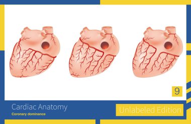 Genel nüfusun çoğunda, posterior inen dal, sağ koroner arterin baskın türü olan ve aynı zamanda en yaygın tür olan sağ koroner arterden kaynaklanır..