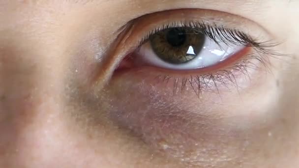 Occhio Umano Caucasico Con Fermo Immagine — Video Stock