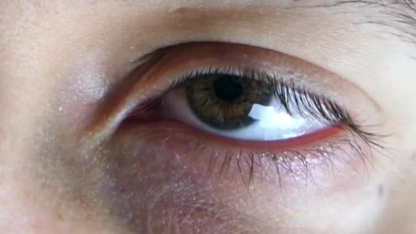 Pele Branca Olho Esquerdo Menino Piscar Com Nistagmo Visual — Vídeo de Stock