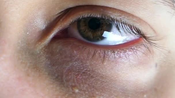 Occhio Sinistro Del Ragazzo Caucasico Con Nistagmo Visivo — Video Stock