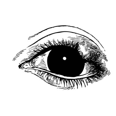 A stye 'ın elle çizilmiş hali, aynı zamanda hordeolum olarak da bilinir. Göz kapağındaki yağ bezinin bakteriyel enfeksiyonu.