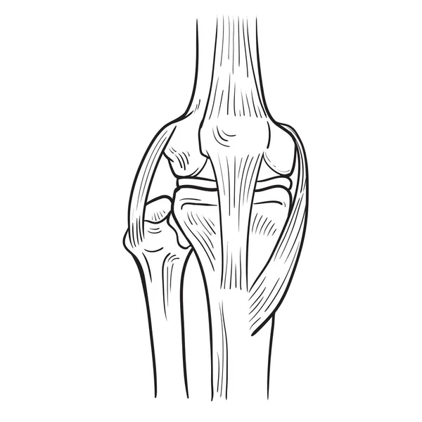 膝の骨 人間の病気の概念 膝の問題の白い背景に署名のベクトル図面 — ストックベクタ