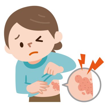 Zona belirtilerinin vektör illüstrasyonuName