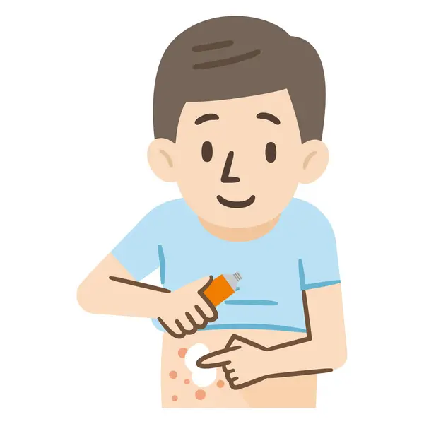 Vector Illustration Man Treating Eczema Ointment — Stock Vector