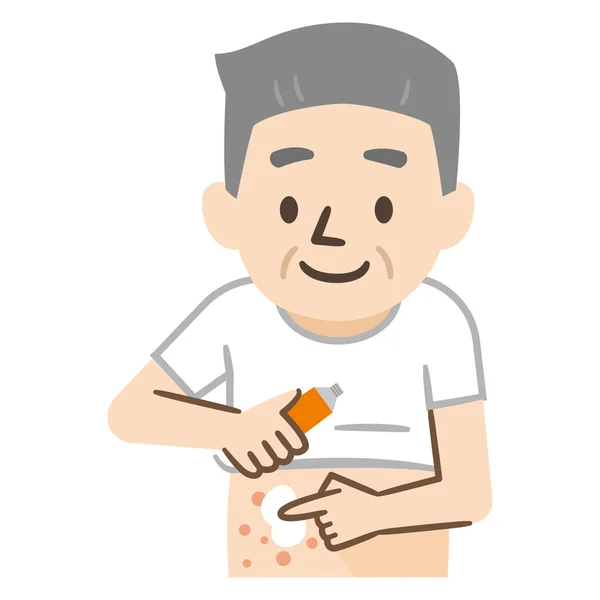 Vector Illustration Senior Man Applying Eczema Medication — Stock Vector