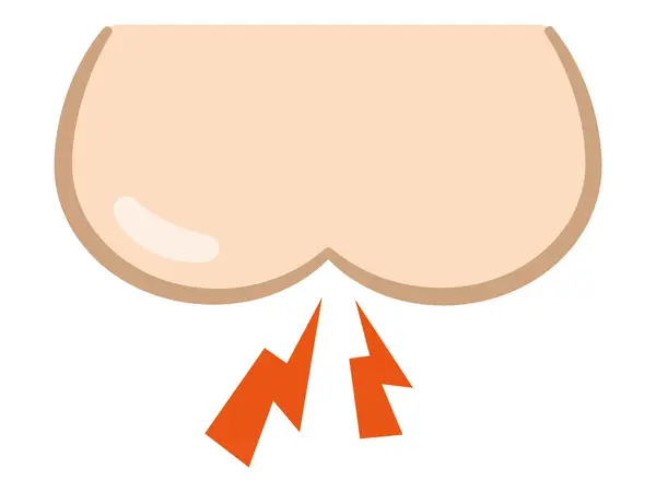Vector Illustration Tingling Butt Stok Vektor Bebas Royalti
