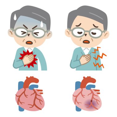 Kalp hastalığından muzdarip yaşlı bir adamın basit bir temsili.