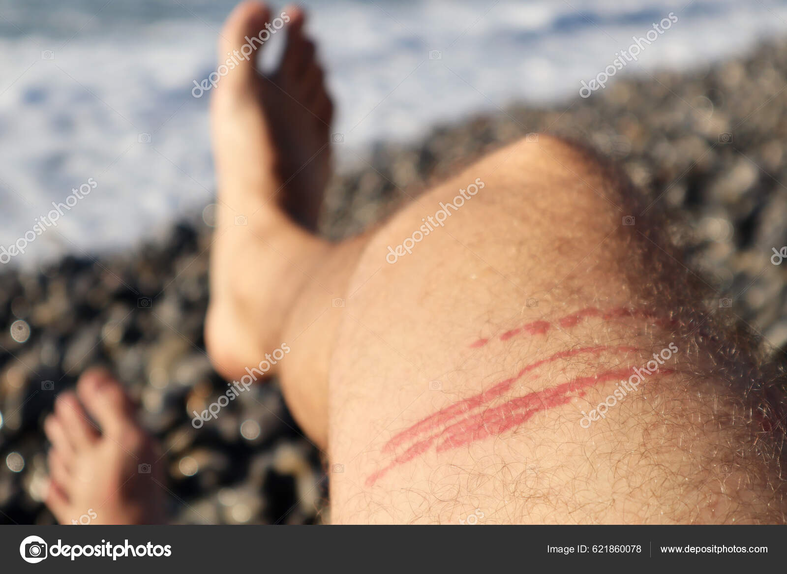 Imágenes de Piel de medusa libres de derechos | DepositPhotos, image size:1600x1167