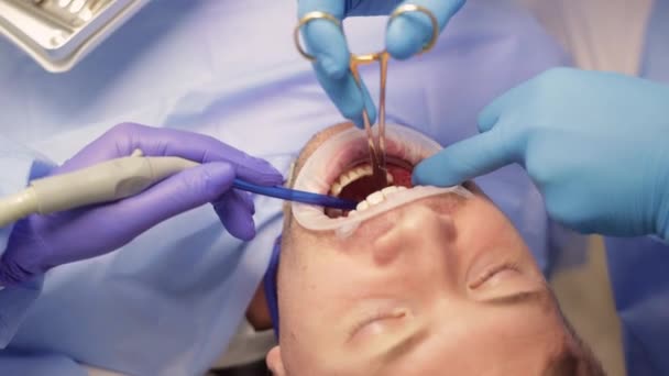 歯科医とアシスタントの縫合患者ガム 口腔歯科手術について — ストック動画