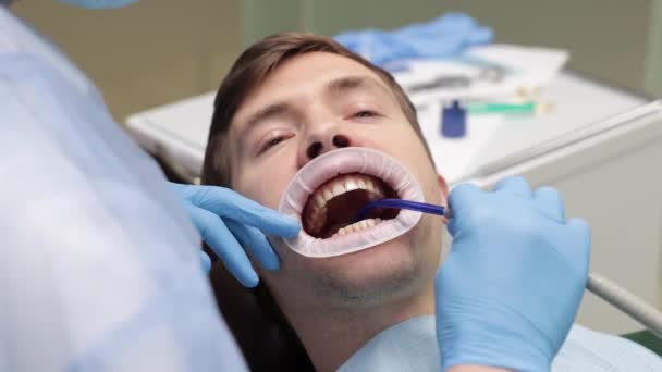 Mann Sitzt Zahnarztstuhl Speichelschleuder Mund Kariesbehandlung Behandschuhte Hände Des Zahnarztes — Stockvideo