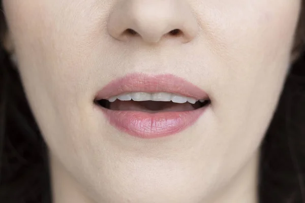 Una Donna Mostra Denti Scheggiati Concetto Trattamento Dentale Morso Dritto — Foto Stock