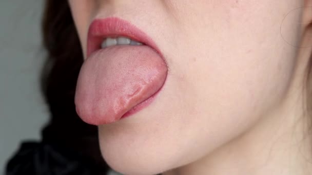 Γυναίκα Δείχνει Πρησμένη Γλώσσα Από Αλλεργίες — Αρχείο Βίντεο