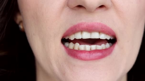 Kvinnan Visar Upp Sina Flisade Tänder Bruxism Stress Malocklusion — Stockvideo