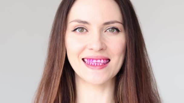 歯科プラークのための錠剤の開示 女性歯のクローズアップ バクテリアプラークを検出するためのピンクタブレット — ストック動画