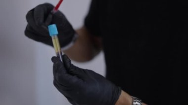 Doktorlar tüpü kanla manipüle ediyorlar - 4K yatay video