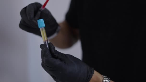 Tangan Dokter Memanipulasi Tabung Dengan Prp Darah Video Horisontal — Stok Video