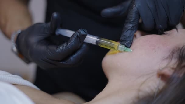 Medische Handen Injecteren Prp Het Gezicht Van Een Patiënt Horizontale — Stockvideo