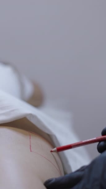 医生用铅笔画出接受中间治疗的区域 Fhd垂直保健 — 图库视频影像