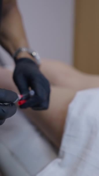 의사는 메소테라피 세션을 시작하는 바늘을 채웁니다 Fhd — 비디오