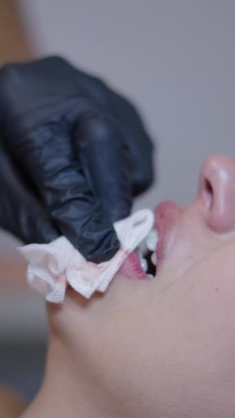 痛哭的女孩在下嘴唇保健概念中注射Fhd垂直注射 — 图库视频影像